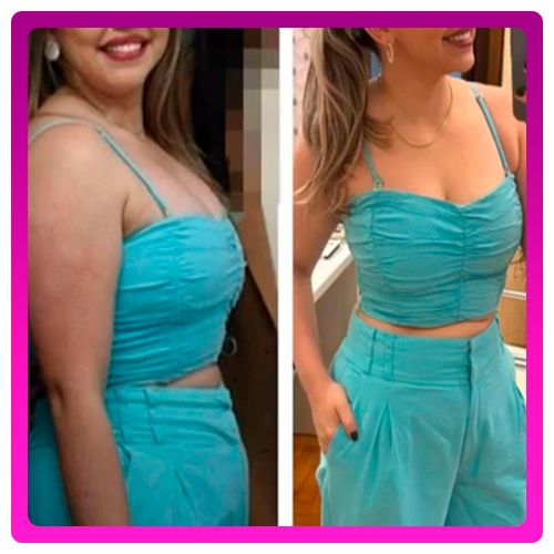 Antes-e-Depois-02