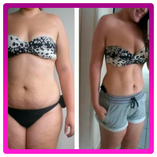Antes-e-Depois-04