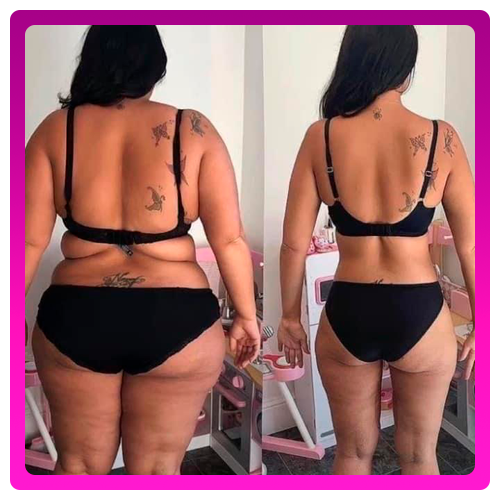 Antes-e-Depois-05