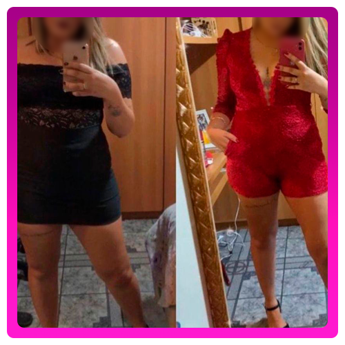 Antes-e-Depois-06