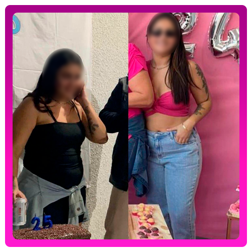 Antes-e-Depois-08